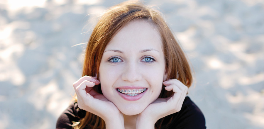 red hair girl smiling with metal braces on her teeth