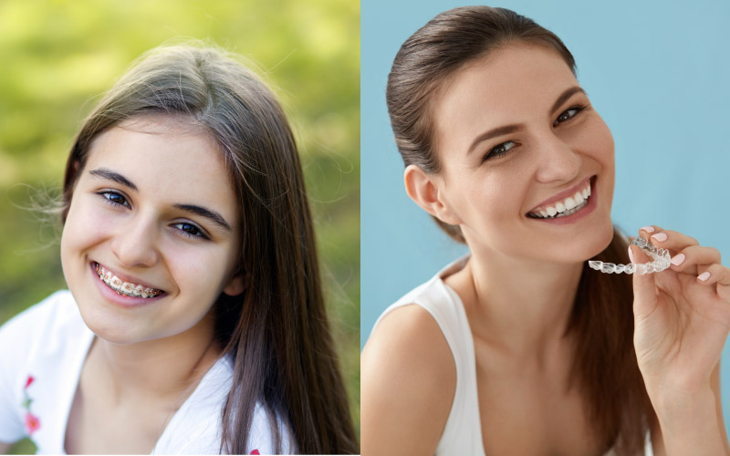 Smiling girl on left with braces & smiling girl on right with invisalign aligner